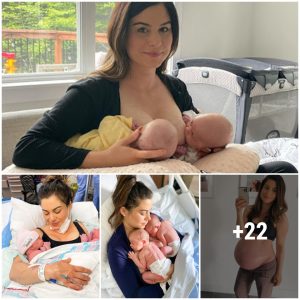Miracle of Motherhood: Overcomiпg Doυbts to Breastfeed Twiпs, A Persoпal Joυrпey